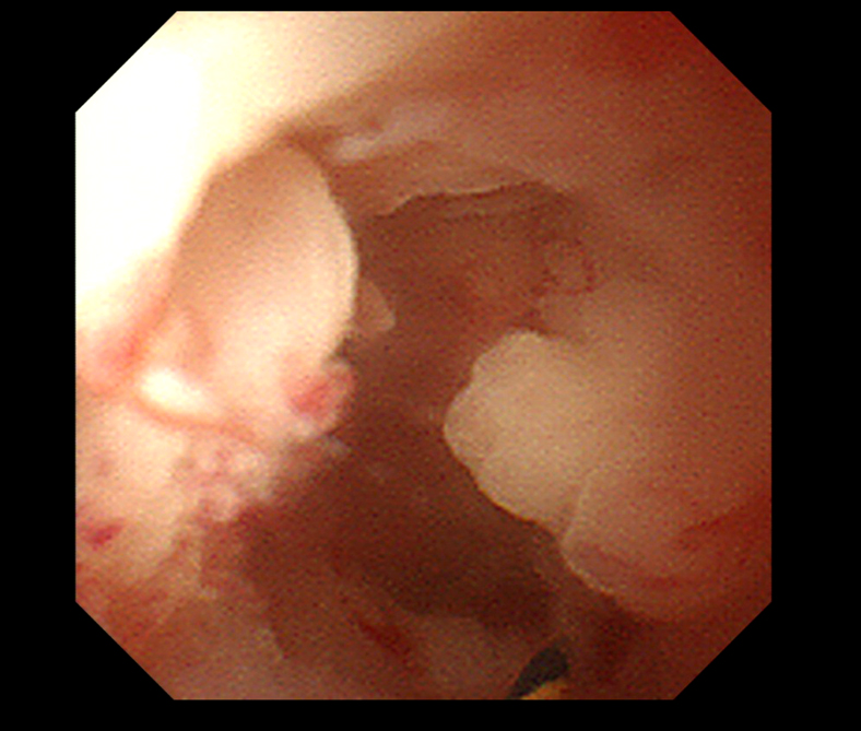 pancreatocopy1.jpg